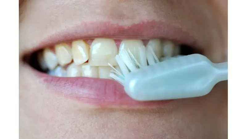 שיניים (צילום Nati Shohat/FLASH90)